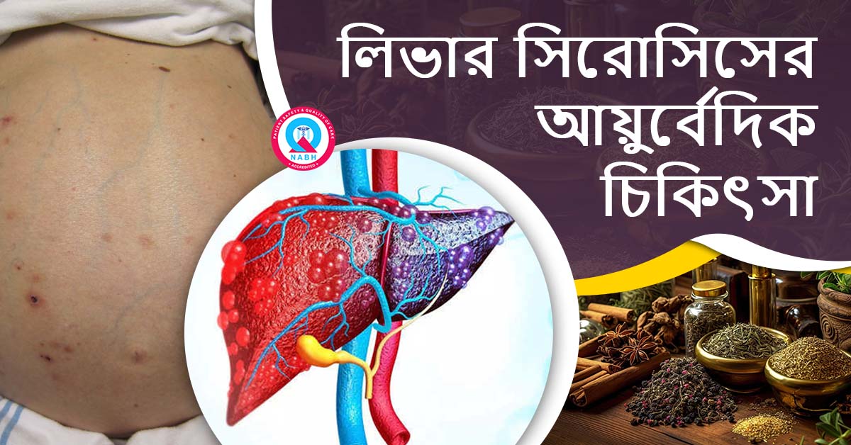 ayurvedic-treatment-for-liver-cirrhosis